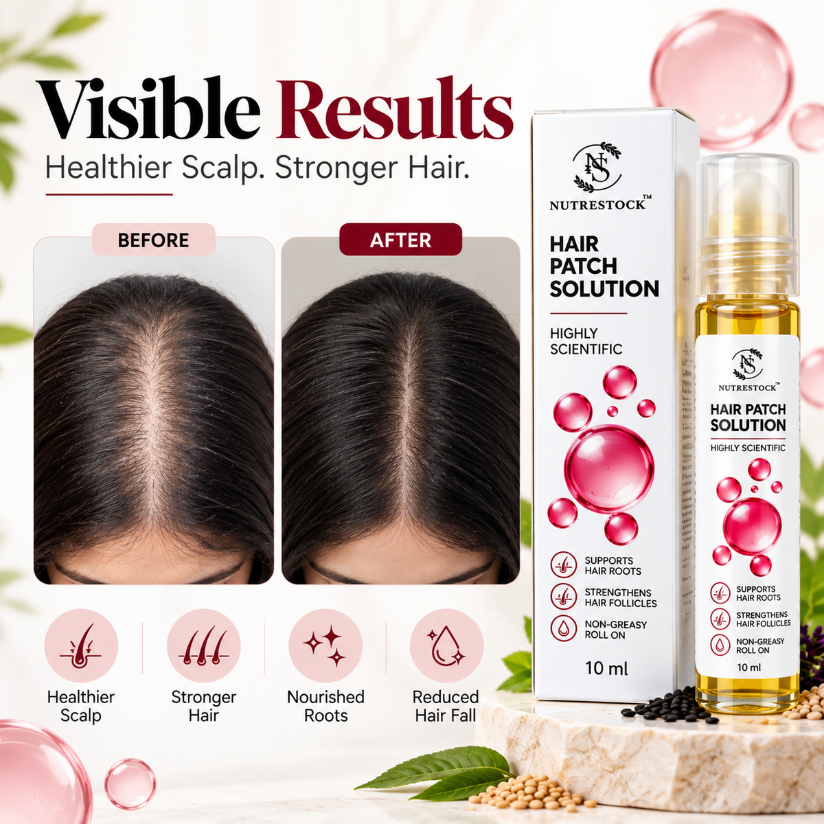 Nutrestock Hair Patch Roll-On for Alopecia & Patchy Hair Loss – 10ml